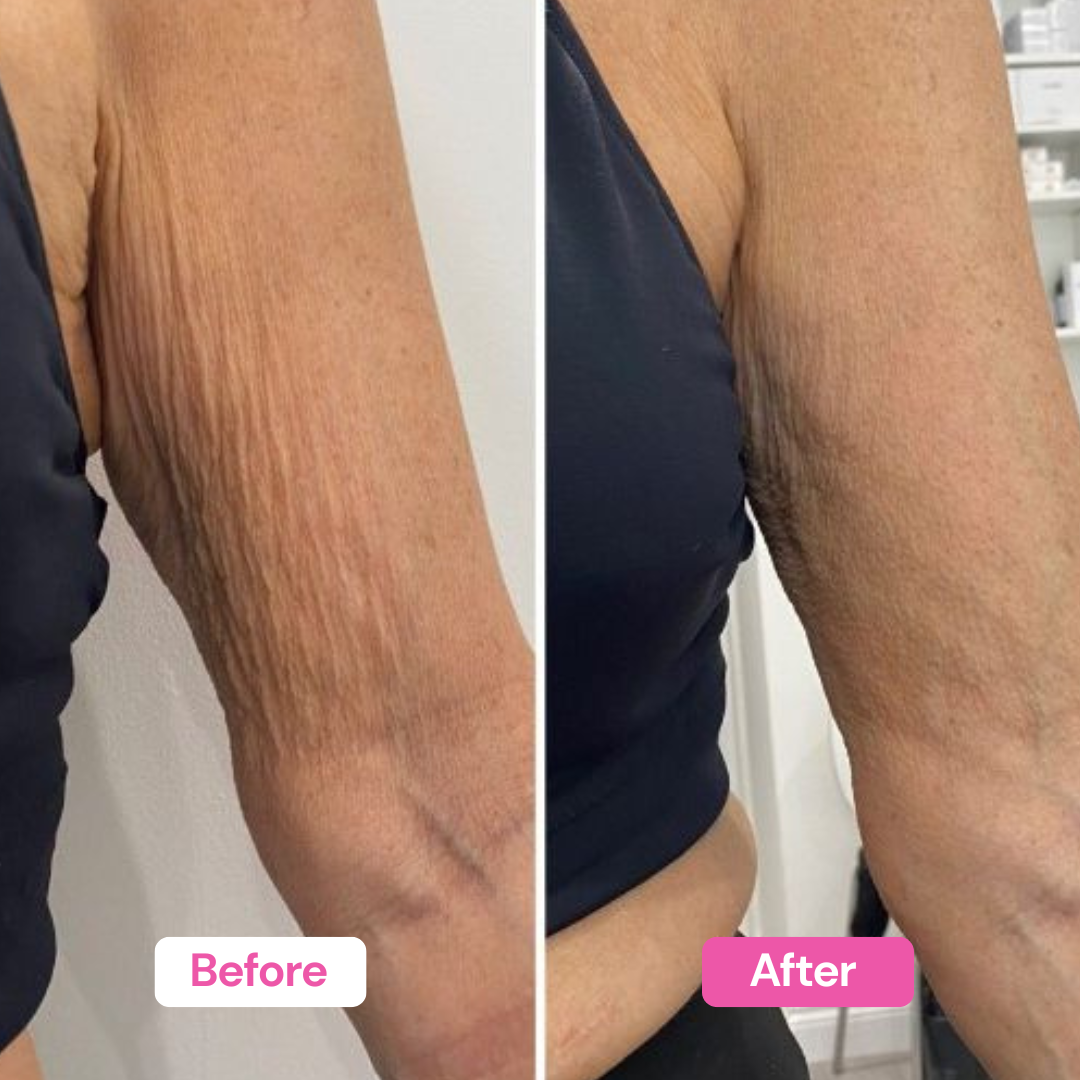 NAD+ Firming Body Cream