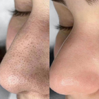 Alaska Volcano Clay Stick Mask