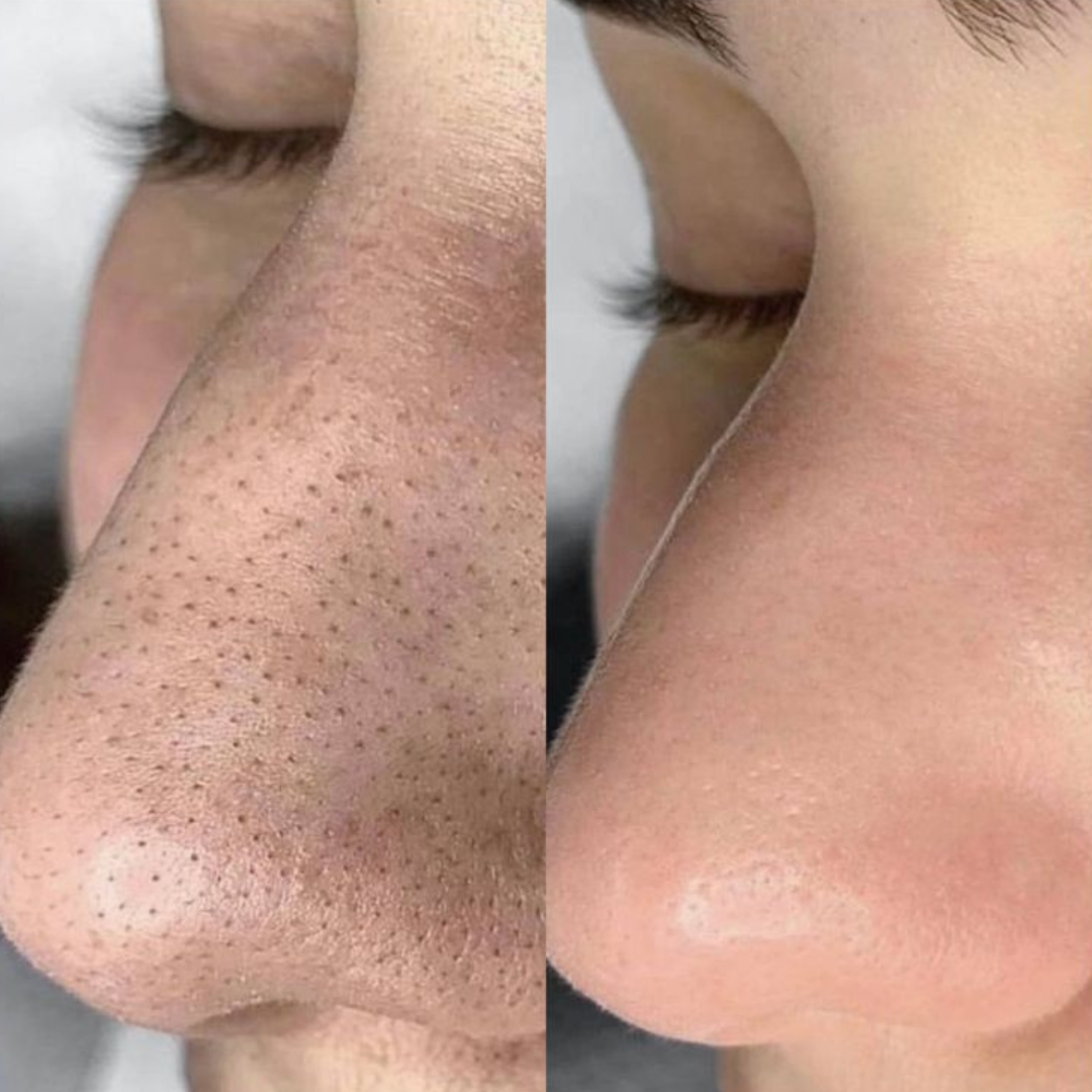 Alaska Volcano Clay Stick Mask