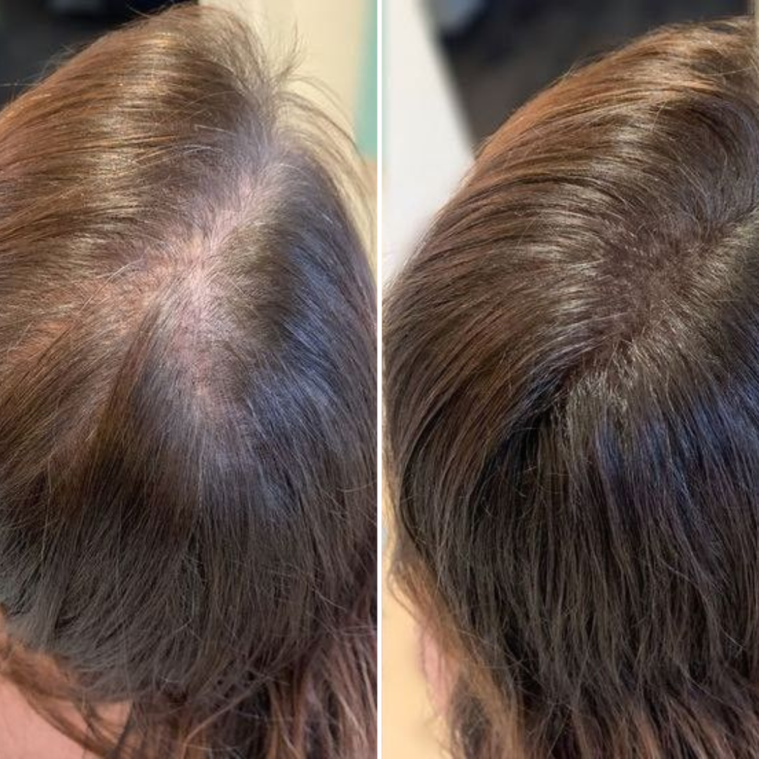Korean Exosome Hair Serum™