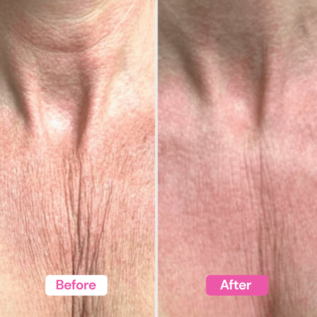 NAD+ Firming Body Cream
