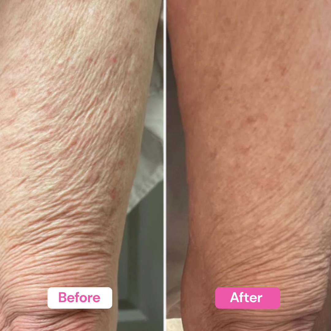 NAD+ Firming Body Cream