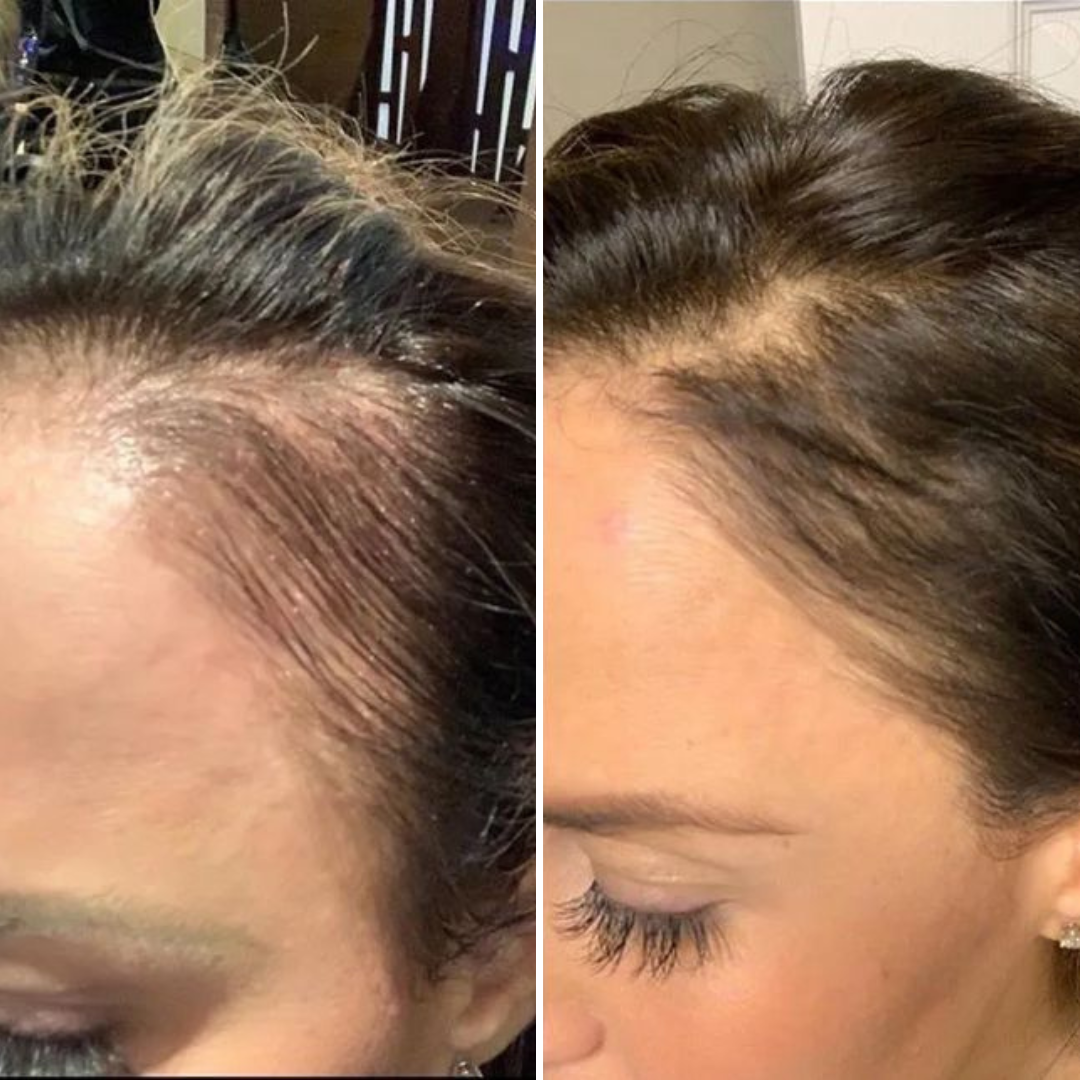 Korean Exosome Hair Serum™