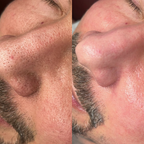Alaska Volcano Clay Stick Mask