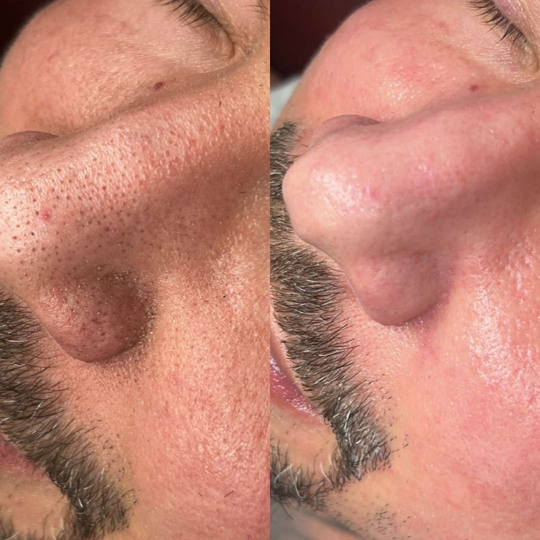 Alaska Volcano Clay Stick Mask